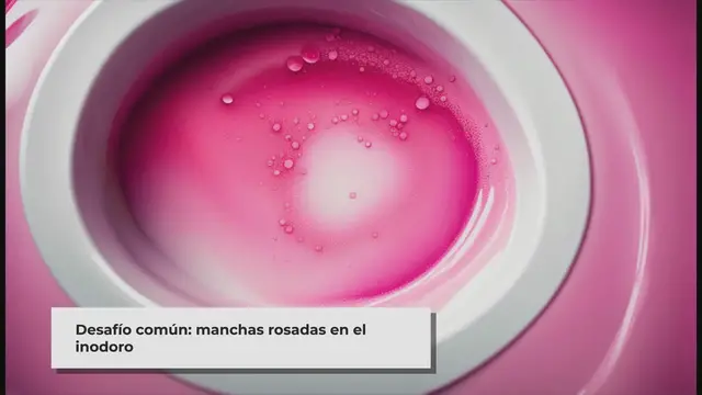 Video thumbnail for ▷ Manchas De Anillo Rosa En Los Inodoros (Causas Y Eliminación)