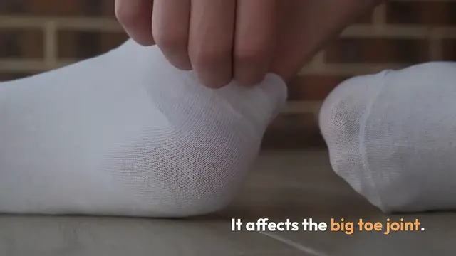 Video thumbnail for Understanding_Bunions_and_Relief_Tips