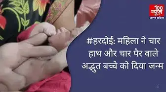 Video thumbnail for #हरदोई: महिला ने चार हाथ और चार पैर वाले अद्भुत बच्चे को दिया जन्म
