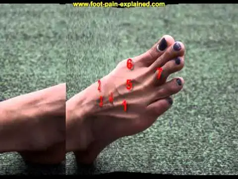 Video thumbnail for ganglion cyst