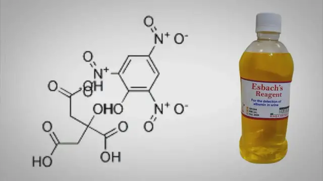 Video thumbnail for Esbach Reagent, Composition, and Uses