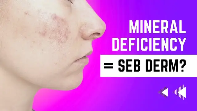 'Video thumbnail for These Mineral Deficiencies Worsen Seborrheic Dermatitis'