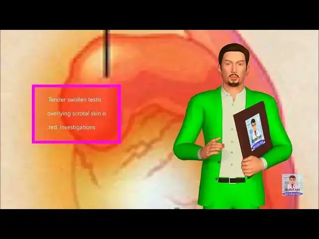 Video thumbnail for Short Medical Notes / TORSION OF THE HYDATID OF MORGAGNI  / Medical Lecture / Medical Video