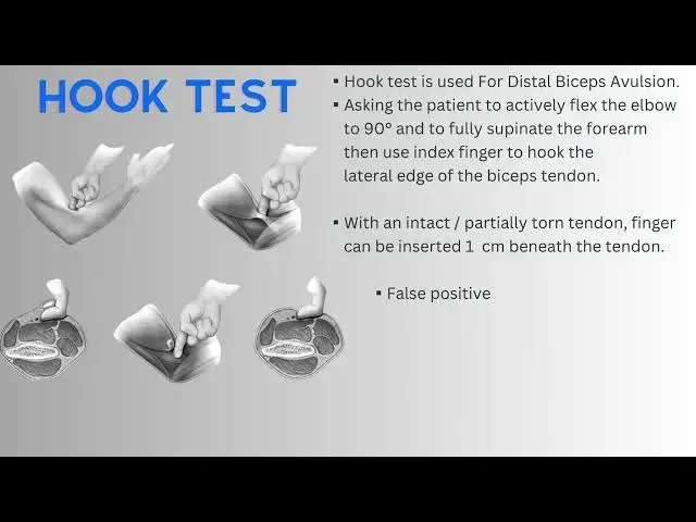 Video thumbnail for Hook test