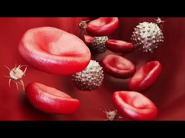 Video thumbnail for Blood Clots in Lungs: How to Recognize and Reduce Risk
