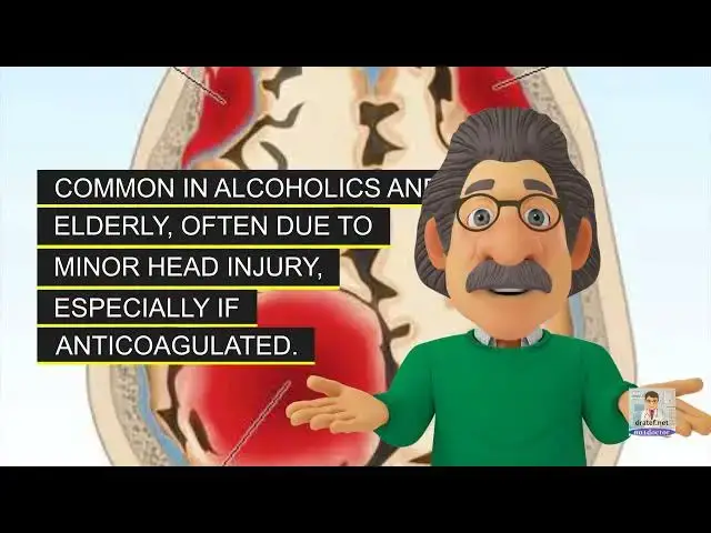 Video thumbnail for Short Medical Notes /Intracranial hemorrhage (ICH)  / Medical Lecture / Medical Video