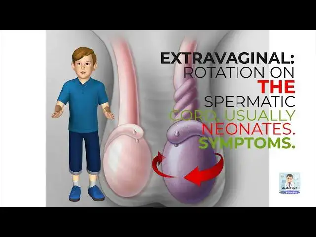 Video thumbnail for Short Medical Notes / Testicular Torsion  / Medical Lecture / Medical Video / Medical Students