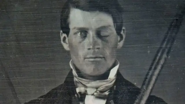 'Video thumbnail for Why Scientists Are Still Fascinated By Phineas Gage'