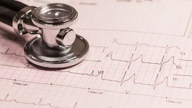 Video thumbnail for Cardiac Axis and Its Significance in Electrocardiogram Interpretation