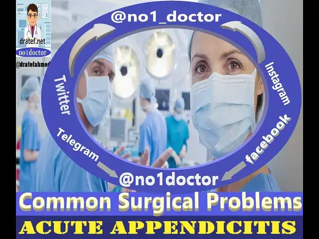 Video thumbnail for Acute Appendicitis/Surgical Problems/Management of Appendicitis/  No1doctor/dratef/Mrcs/ Frcs/Usmle