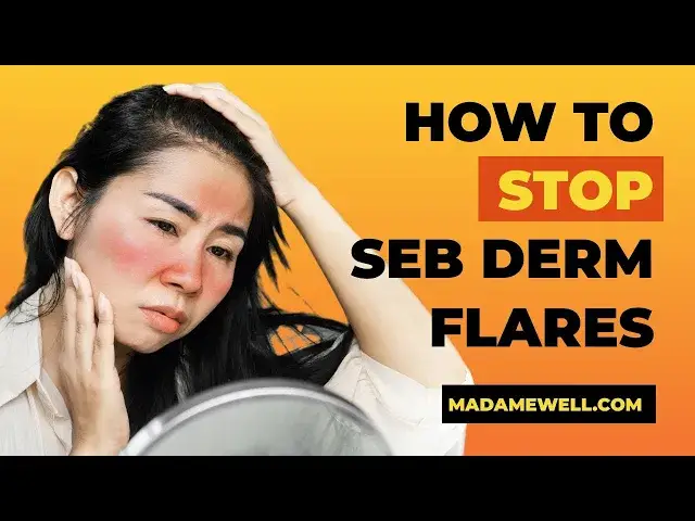 'Video thumbnail for The Secret To Stopping A Seb Derm Flare'