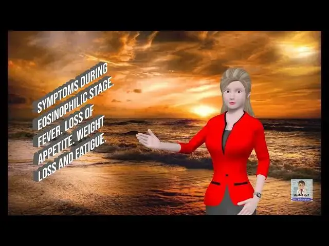 Video thumbnail for Churg strauss Syndrome