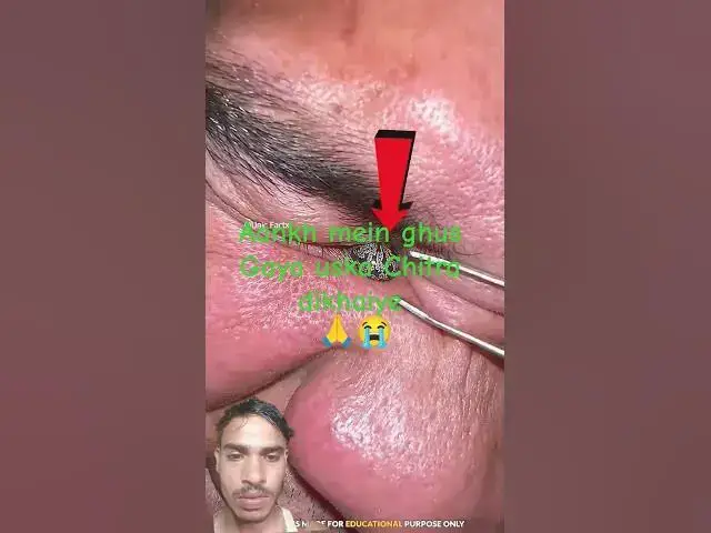 Video thumbnail for 29 June 2025