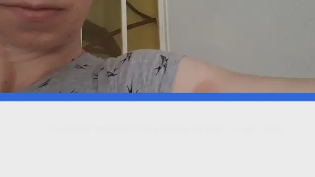 Video thumbnail for Tekenbeet bij kinderen – een voorlichting week van de teek