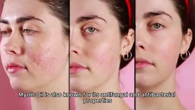 'Video thumbnail for Myrrh Oil benefits'