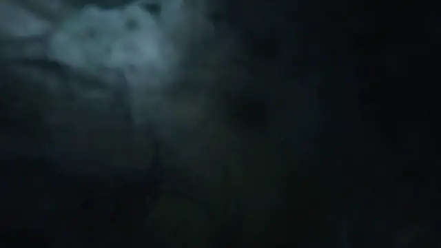 Video thumbnail for What You Should Know If You Wear Contact Lenses