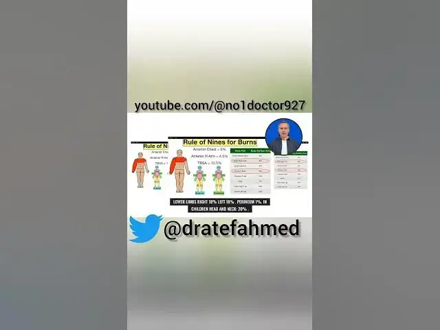 Video thumbnail for #burn areas #shorts #burn #burninjury #surgeon #plasticsurgeon #mrcs #usmle #dratef #no1doctor