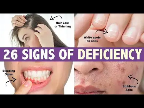 Video thumbnail for 10 Warning Signs Your Body Is Deficient in Nutrients