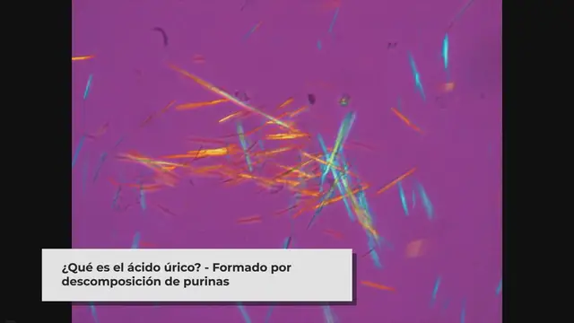 Video thumbnail for Síntomas de Ácido Úrico Alto en Mujeres: ¿Cómo Identificarlo? video