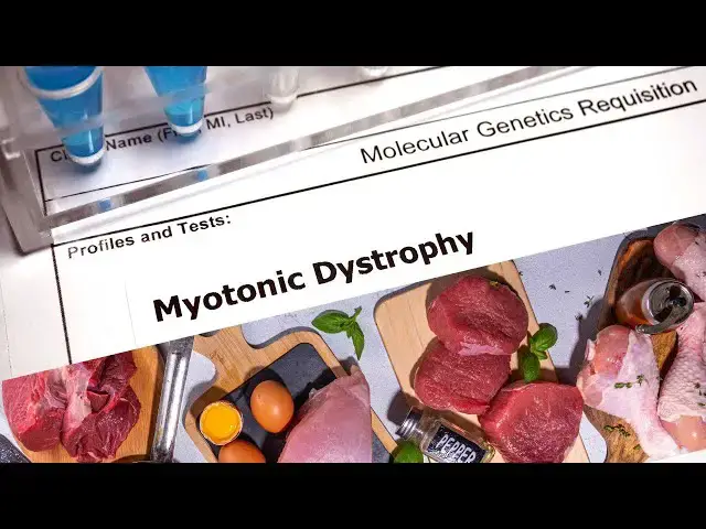 Video thumbnail for Can a carnivore diet help with myotonic dystrophy