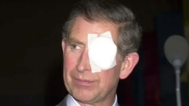 Video thumbnail for These Royal Injuries Are Ones That The World Couldn't Ignore