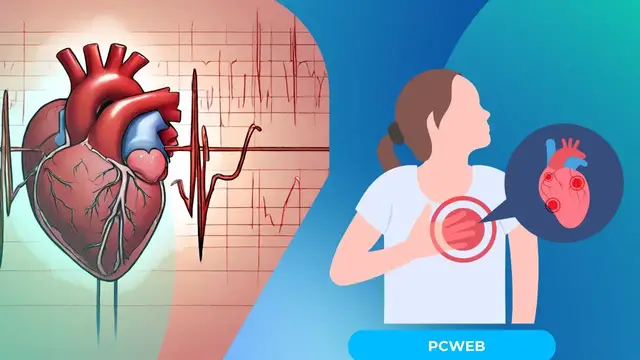 Video thumbnail for Que es arritmia cardíaca: video blog